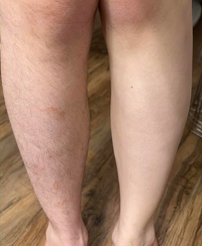 Customer result photo